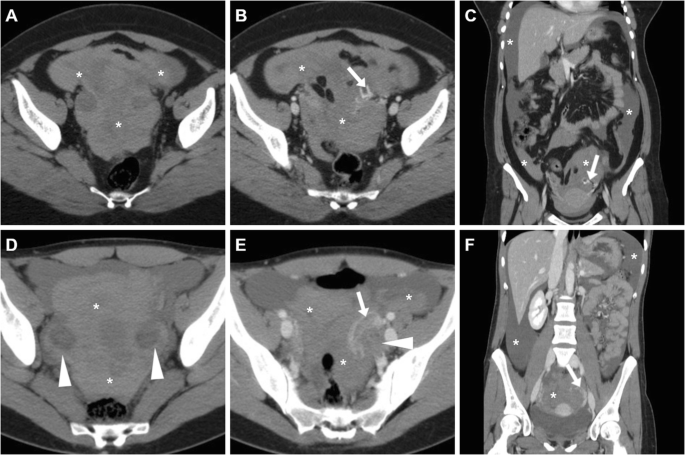 figure 16