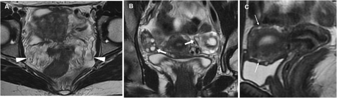 figure 24