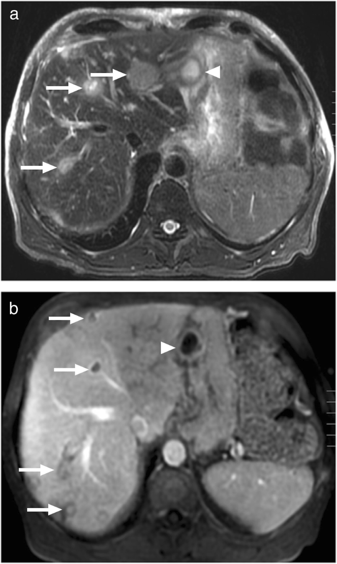 figure 16