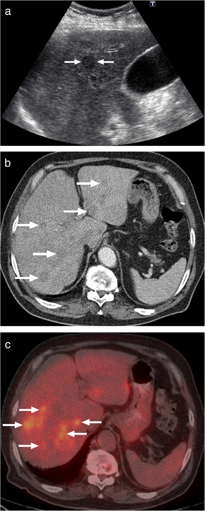 figure 18