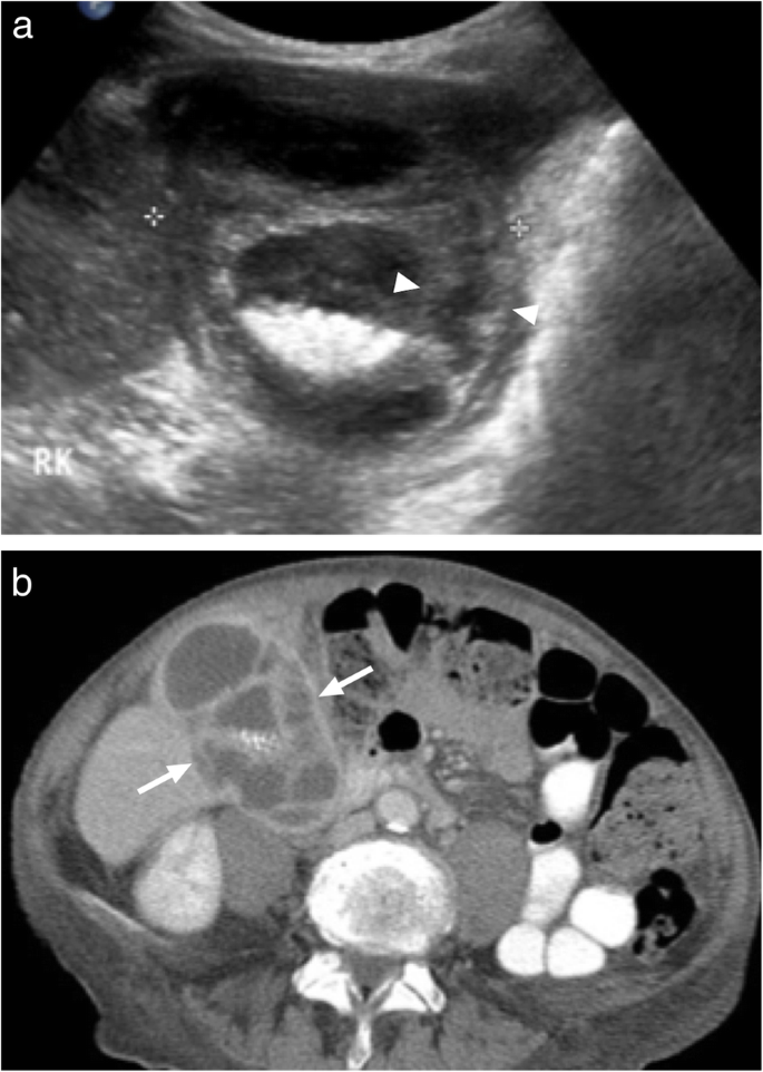 figure 24