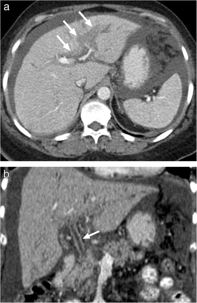 figure 25