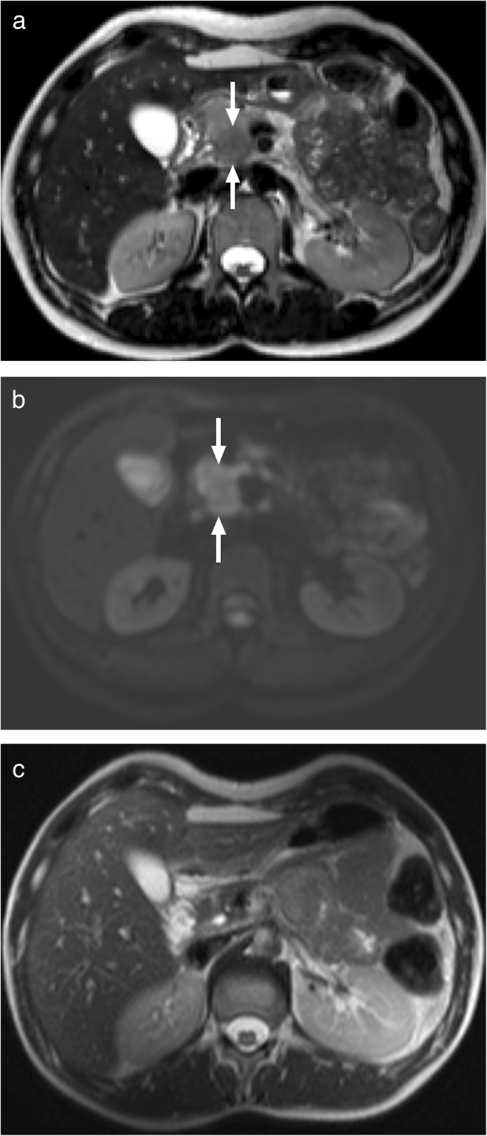 figure 27