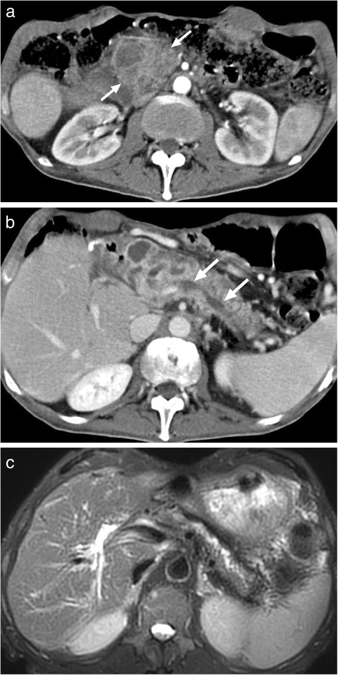 figure 29