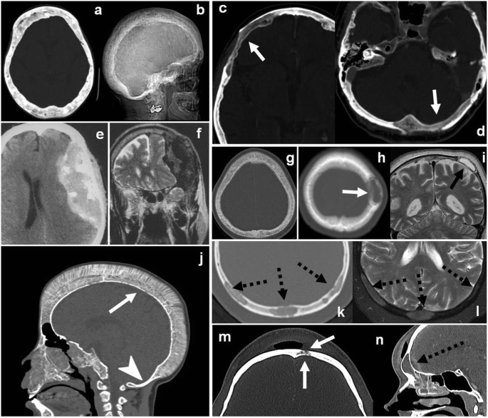 figure 16