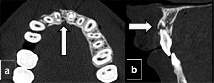 figure 15