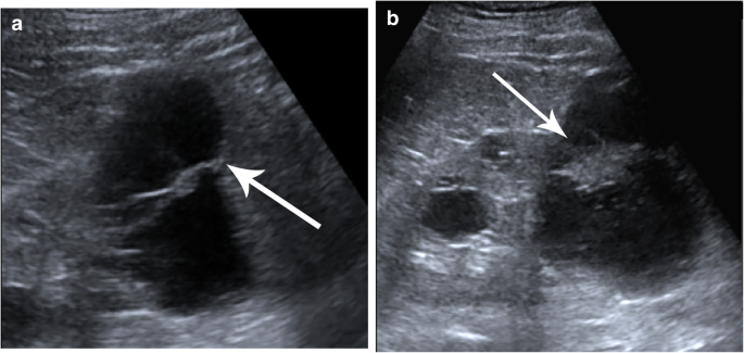 figure 18