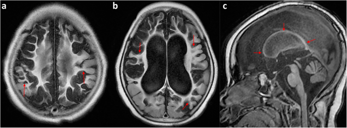 figure 15