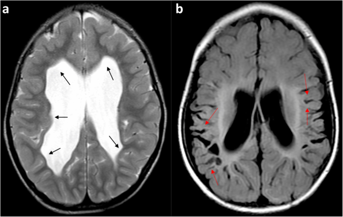 figure 18