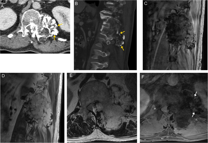 figure 18