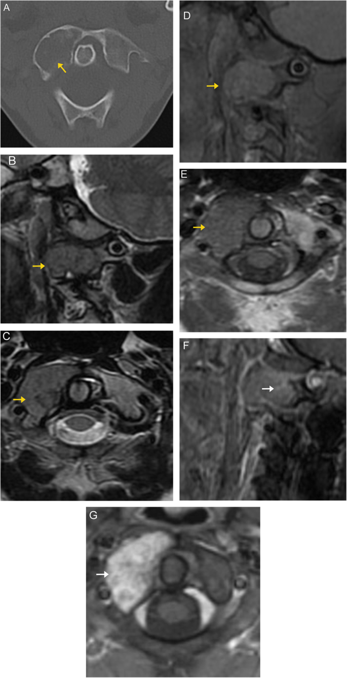 figure 19