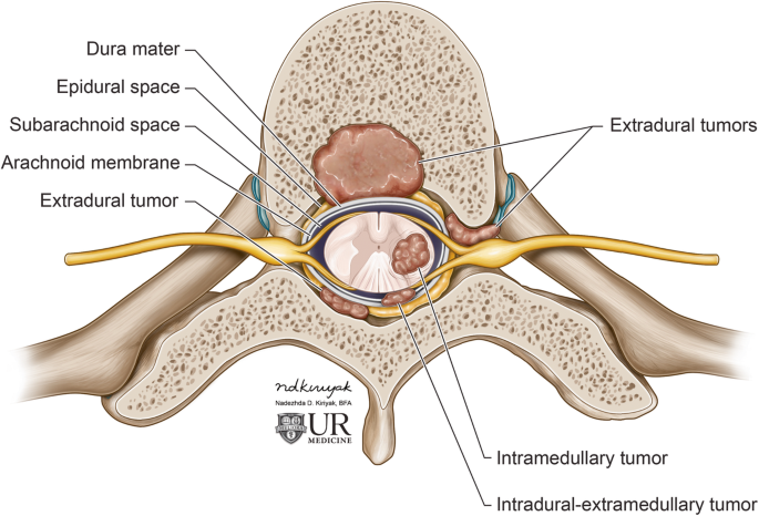ventral epidural space