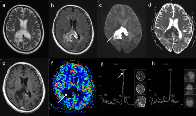 figure 17