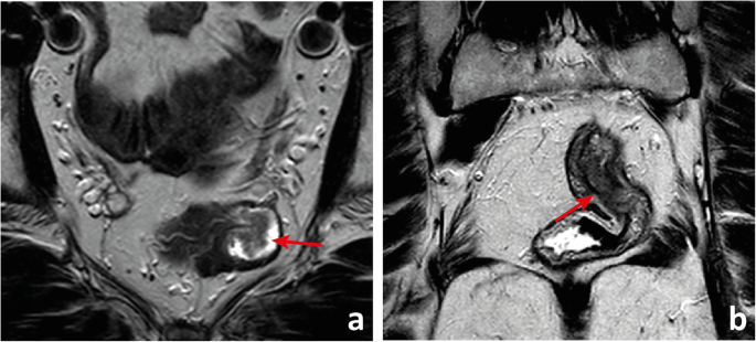 figure 18