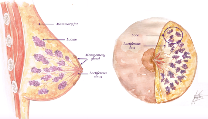 Intraductal papilloma inverted nipple. Remedii-homeopate, Intraductal papilloma inverted nipple