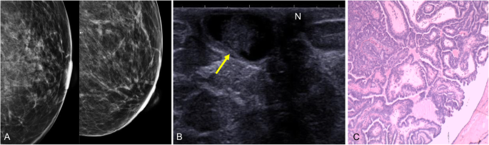 figure 24