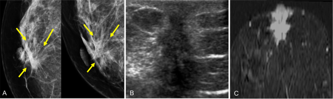 figure 32