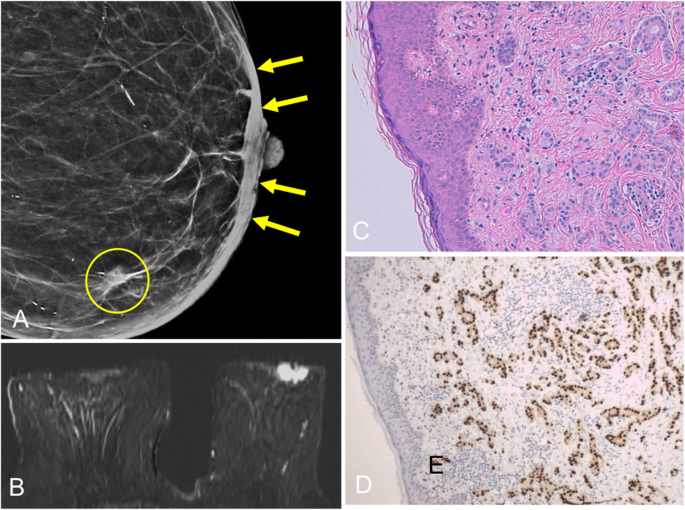 figure 35