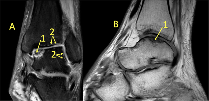 figure 18