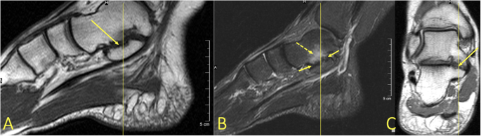 figure 23