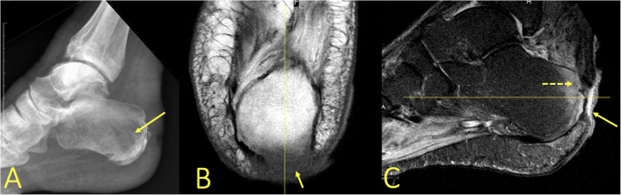 figure 27