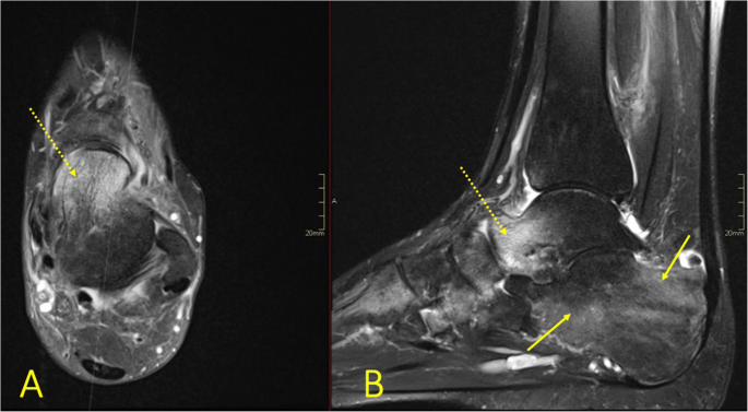 figure 28