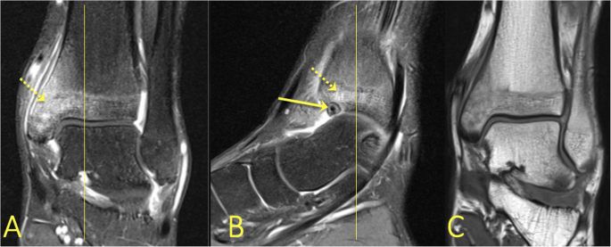 figure 31