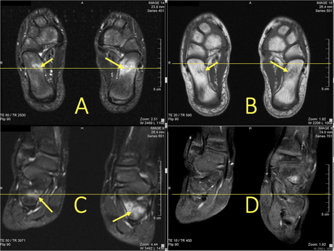 figure 33