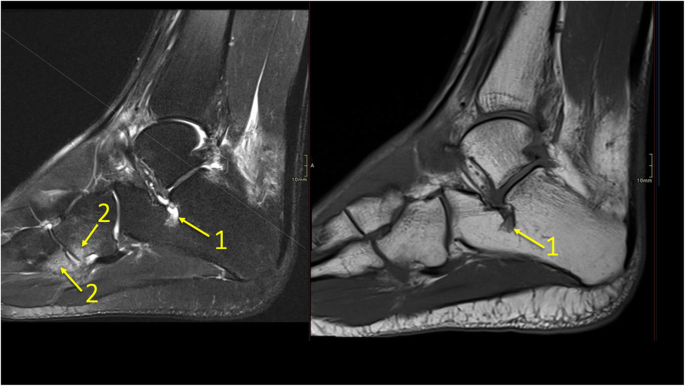 figure 34