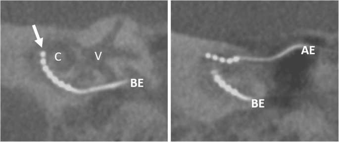 figure 21