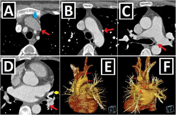 figure 18