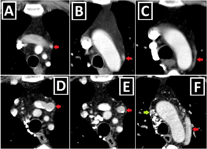 figure 21