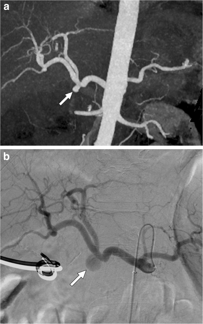 figure 29