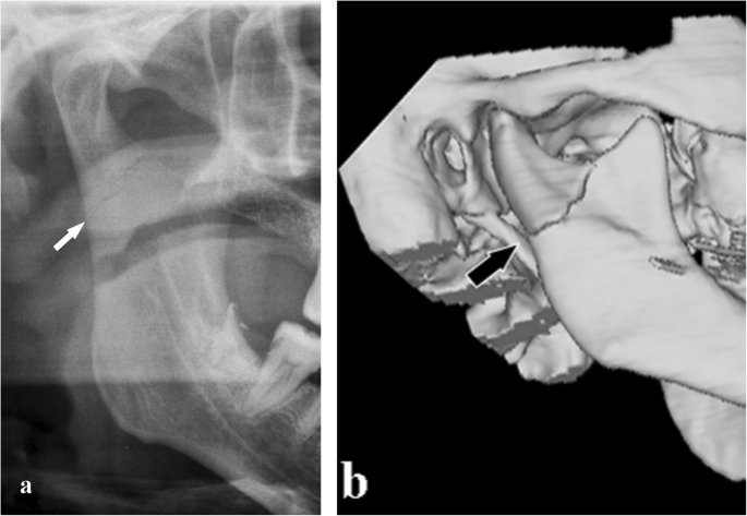 figure 14