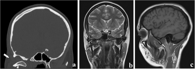 figure 18