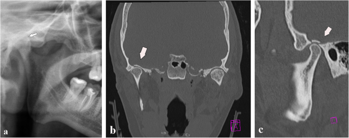 figure 19