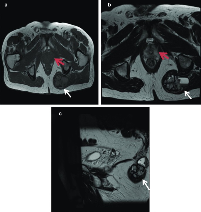 figure 15