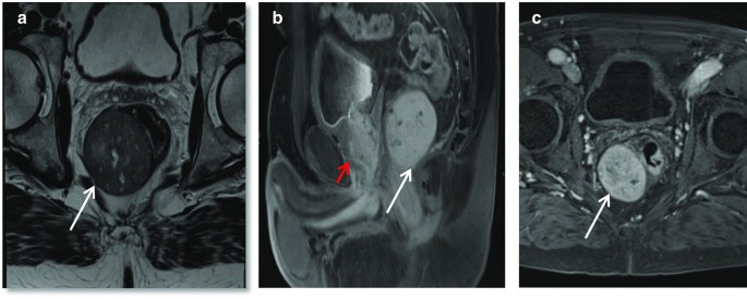 figure 22