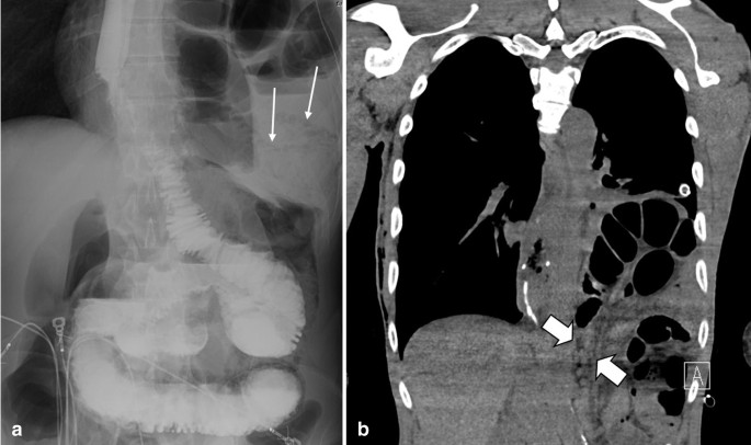 figure 19