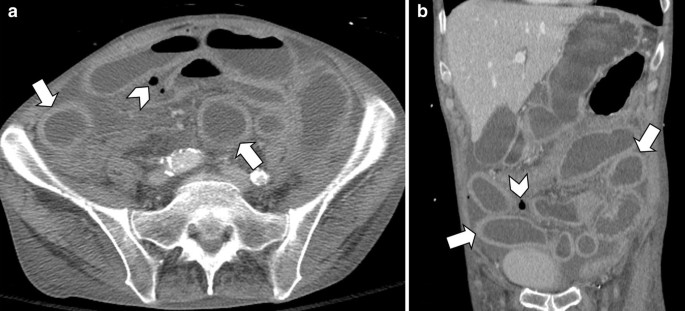 figure 23