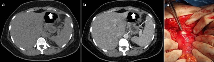 figure 27