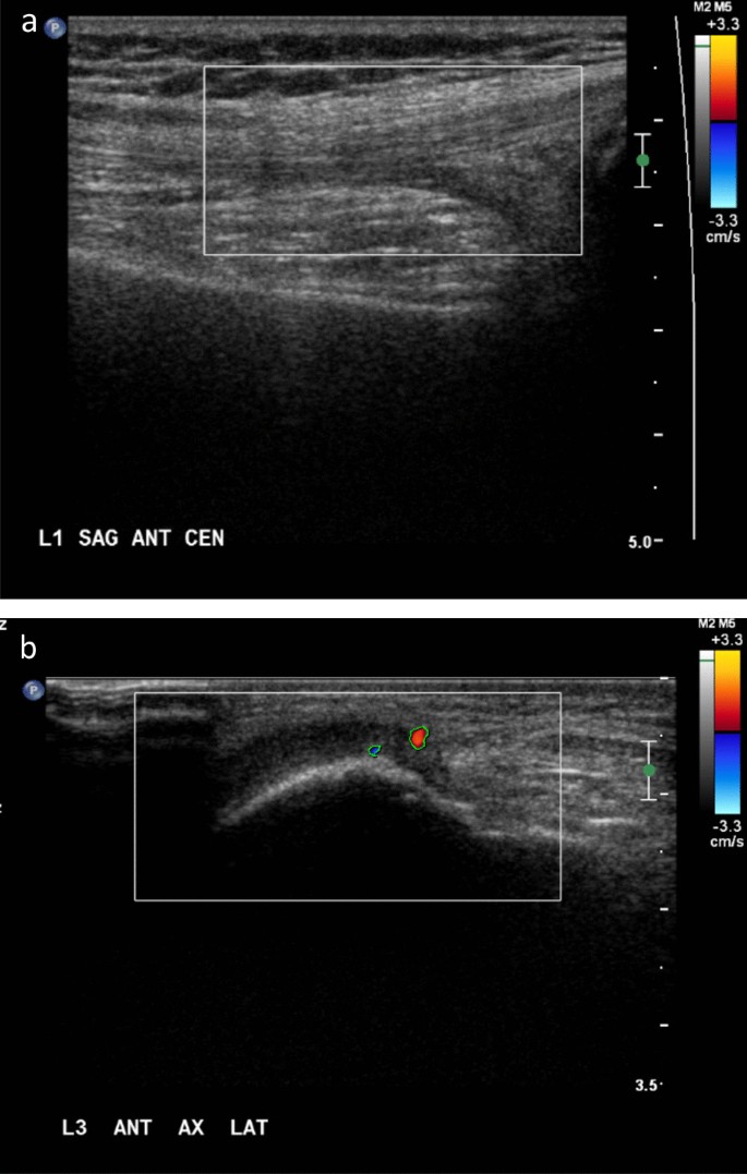 figure1