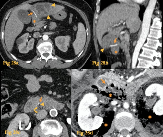 figure 28