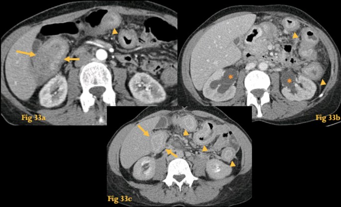 figure 33