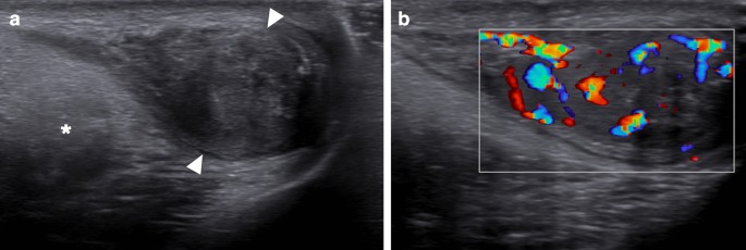 figure 22