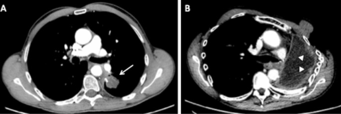 figure 18