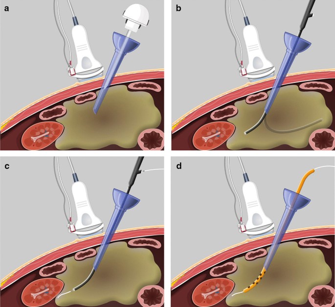 figure1