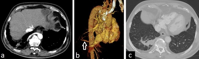 figure 25