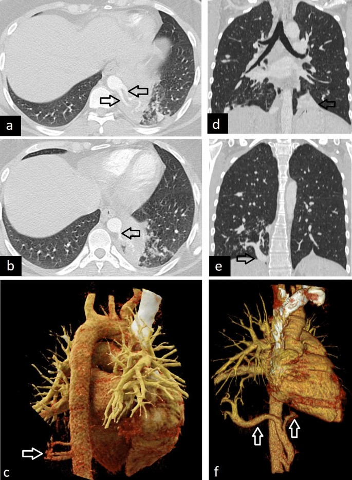 figure 26