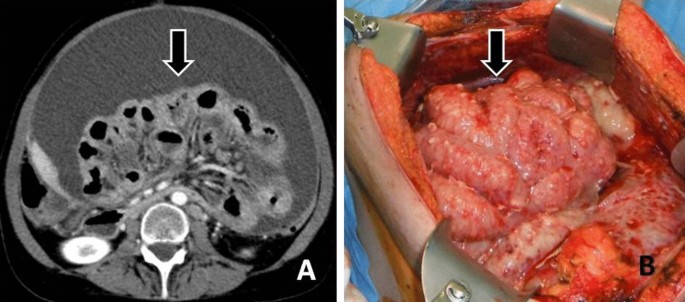 figure 15